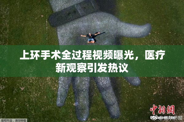 上环手术全过程视频曝光，医疗新观察引发热议