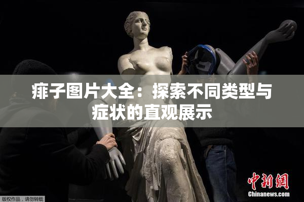 痱子图片大全：探索不同类型与症状的直观展示