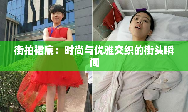 街拍裙底：时尚与优雅交织的街头瞬间