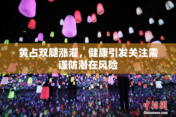 黄占双腿涨灌，健康引发关注需谨防潜在风险