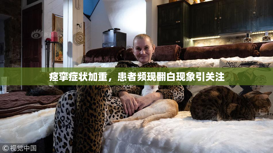 痉挛症状加重，患者频现翻白现象引关注