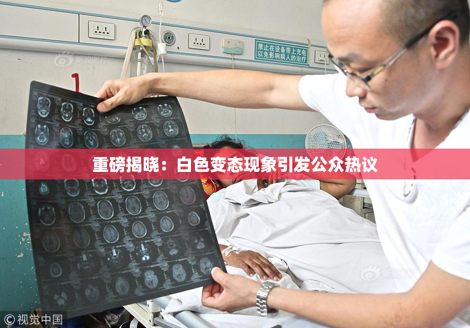 重磅揭晓：白色变态现象引发公众热议