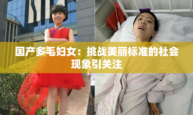 国产多毛妇女：挑战美丽标准的社会现象引关注