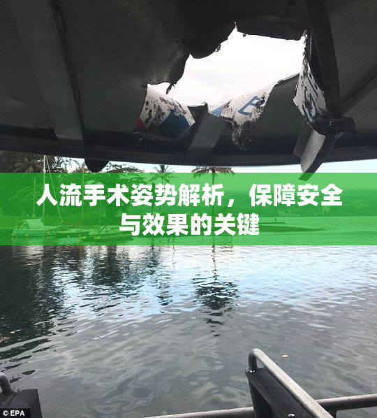 人流手术姿势解析，保障安全与效果的关键
