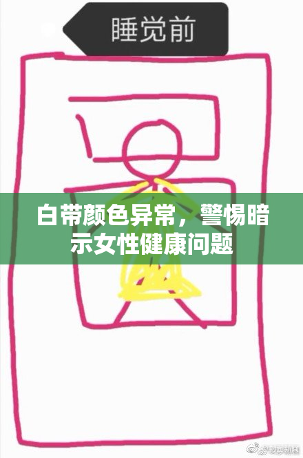 白带颜色异常，警惕暗示女性健康问题