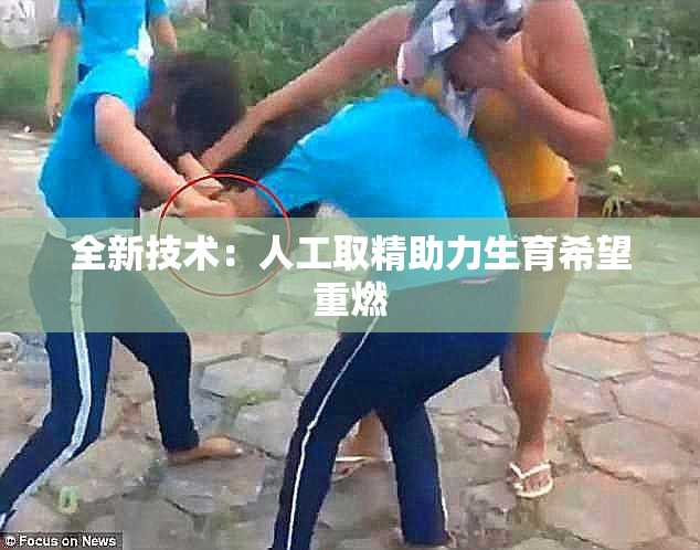 全新技术：人工取精助力生育希望重燃