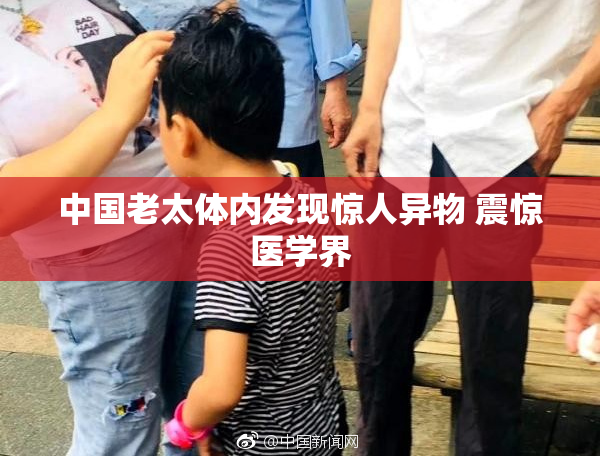 中国老太体内发现惊人异物 震惊医学界