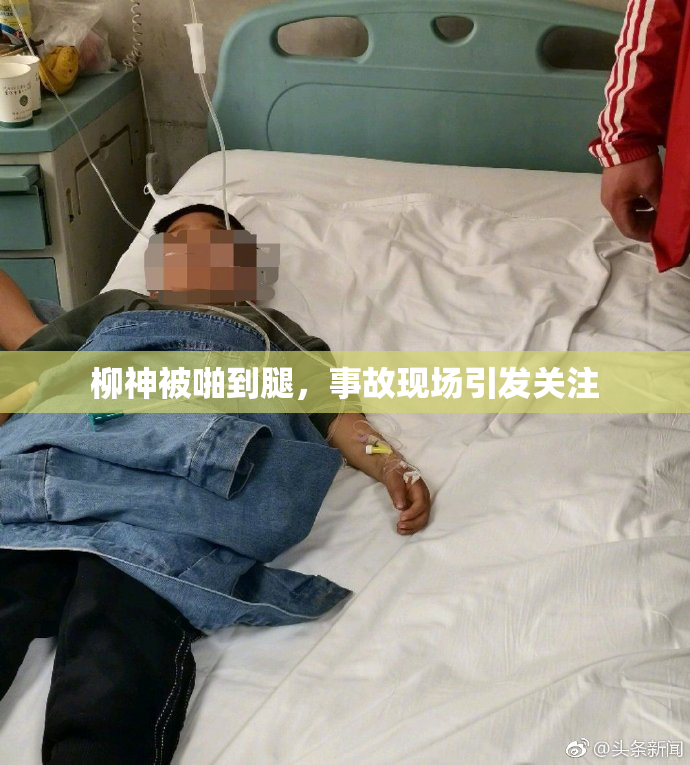 柳神被啪到腿，事故现场引发关注