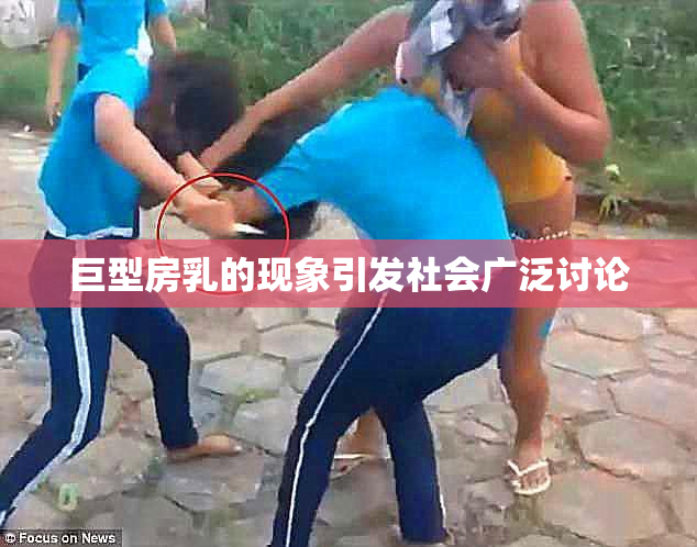 巨型房乳的现象引发社会广泛讨论