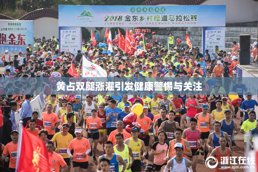 黄占双腿涨灌引发健康警惕与关注